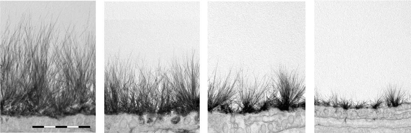 Microvascular Health Solutions | Glycocalyx: An Invisible Shield Clinically Shown to Protect Health